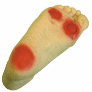 Advanced Diabetic Foot Care Model (Imported)