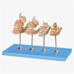 Development of a Set of Teeth