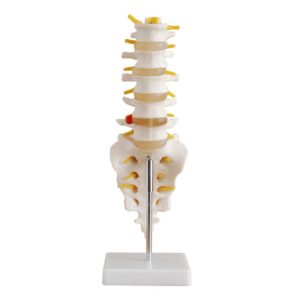 Lumbar Vertebrae with Sacrum & Coccyx and Herniated Disc Life-Size