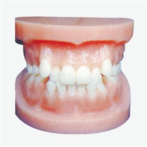 Orthodontic Model