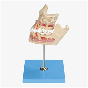 Pathologic Tooth With Jaw