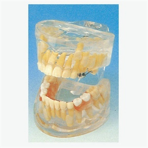 Transparent Milk teeth Development Model